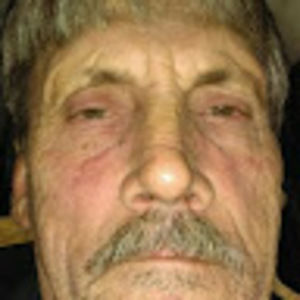 Meet your Posher, Eddie